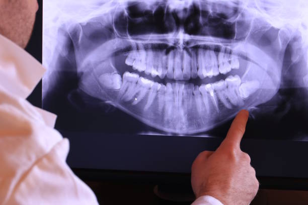 Best Same-Day Emergency Dental Services in St Martin, MS