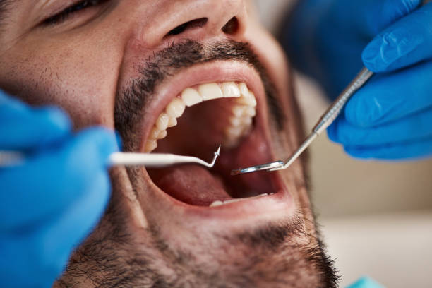Best Cosmetic Emergency Dentistry in St Martin, MS