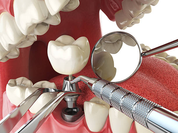 Best Same-Day Emergency Dental Services in St Martin, MS